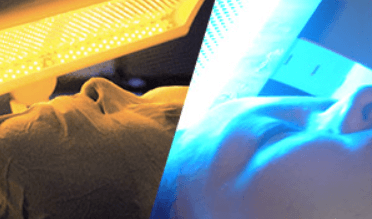 エルセーヌのニキビ集中ケア体験コースでは、黄色・青色のLEDを使用して光フェイシャルを行います。）