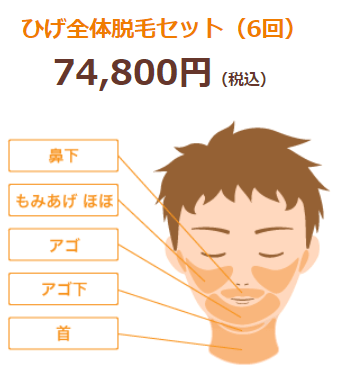 ドクター松井クリニック男性ヒゲ脱毛全体料金と施術範囲