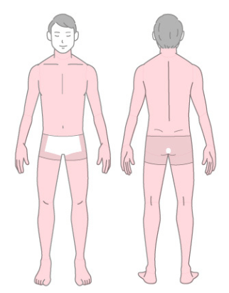 エミシアクリニックメンズ脱毛_まるっと全身脱毛プラン(顔・VIO含まない)脱毛料金