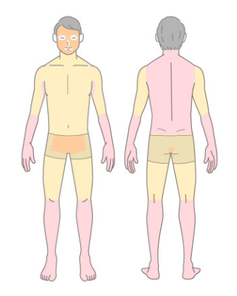 エミシアクリニックメンズ脱毛全身＋顔＋VIOプラン脱毛料金