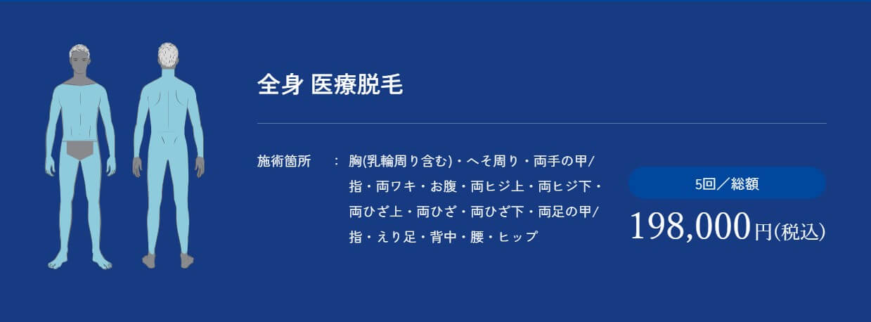 メンズアリシアクリニック仙台院全身医療脱毛5回キャンペーン