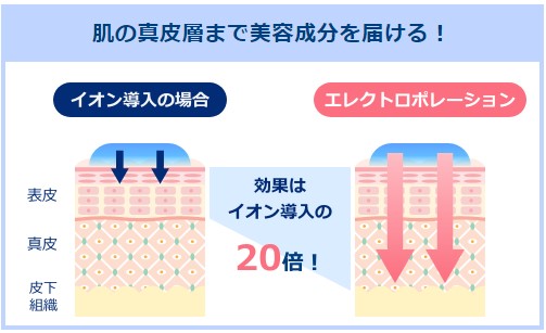 ストラッシュ高崎駅前店エレクトロポレーション